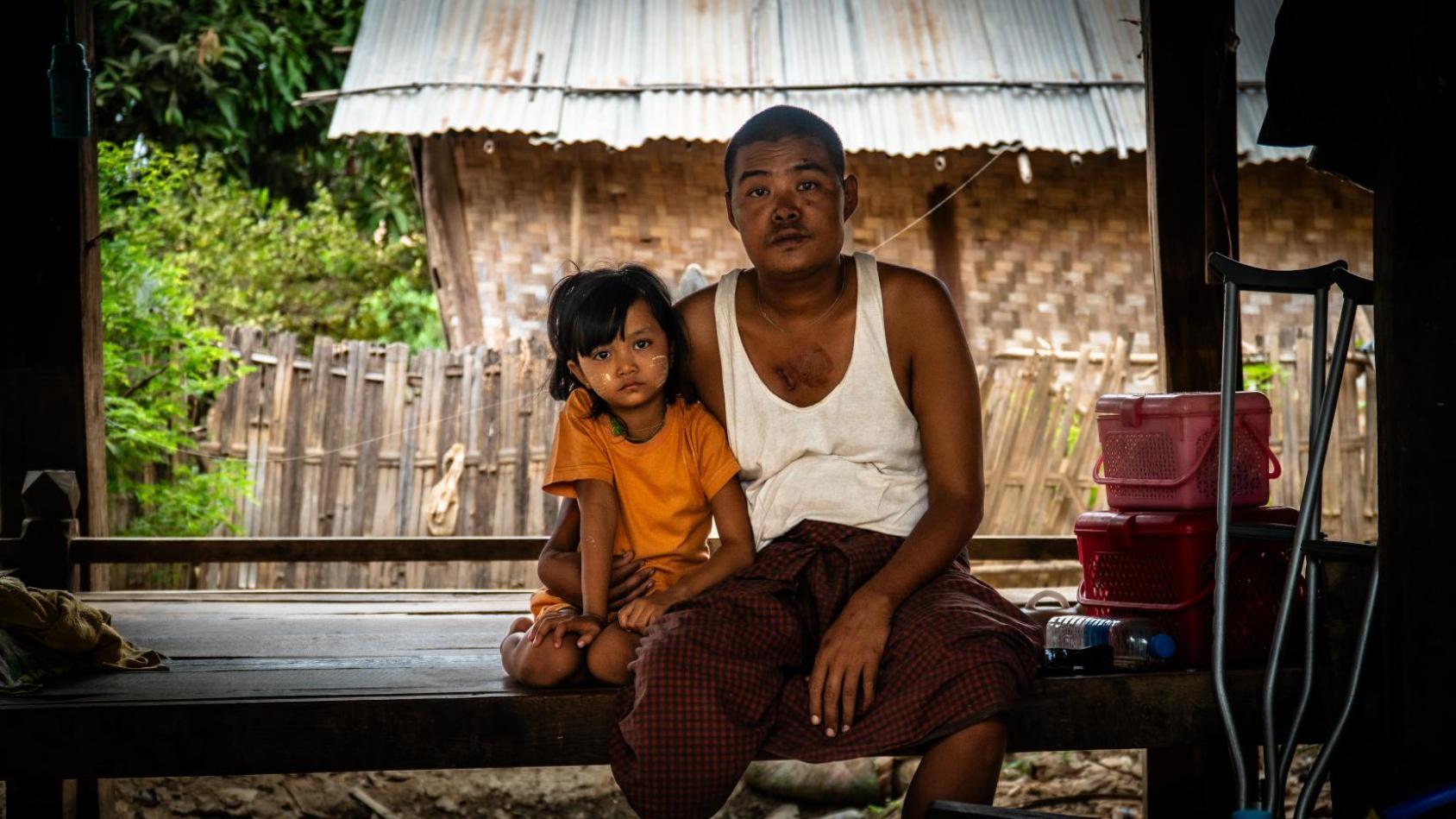  A man who lost his right leg in a devastating flood and later lost his wife in a powerful earthquake and his 4-years-old daughter