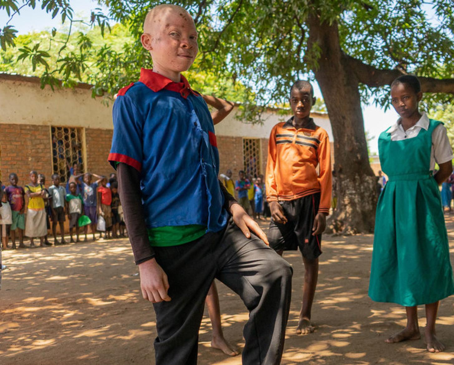 Chinsisi Jafali, a 14-year-old with albinism in Malawi stands proudly alongside his classmates.